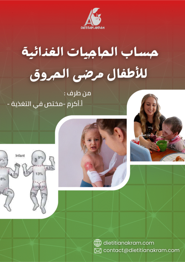 حساب حاجيات الأطفال المصابين بالحروق